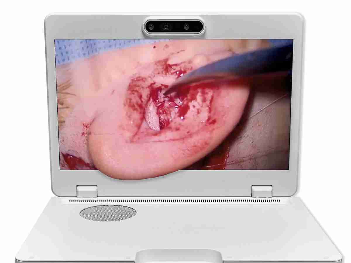 达擎之＂Heads-up 3D显微手术显示系统＂，，，整合4K裸眼3D显示及眼球追踪系统，，，具备快速追踪人眼移动位置功能，，，，减轻医师长时间维持固定姿势的负担，，让医师能有更宽广清晰的3D立体视野及更舒适的姿势来执行手术。。。。